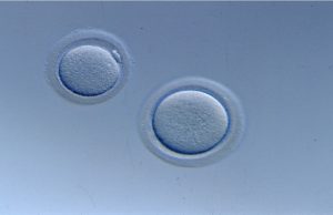 O que define uma fêmea? O que define uma fêmea?